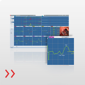 NeuroExplorer 2019 - A nova geração de software IONM